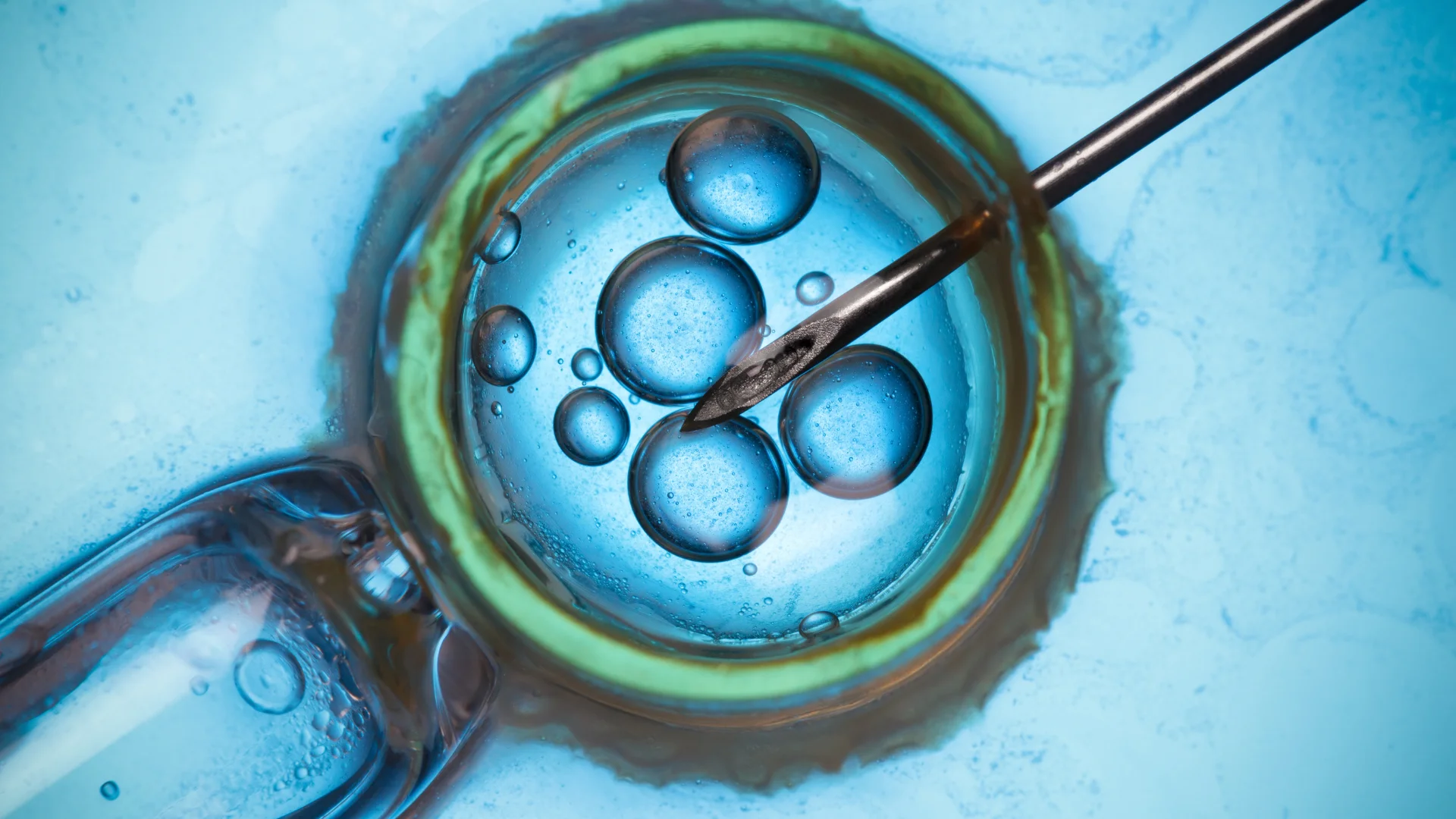 Embryo screening